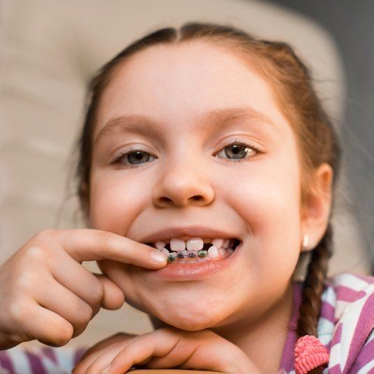 Young girl with braces on bottom teeth pointing to her smile